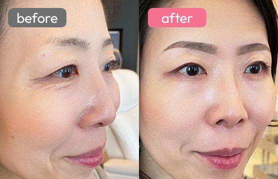 眉アートメイク-046 03