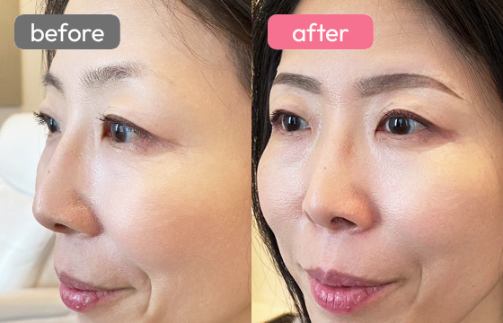 眉アートメイク-046