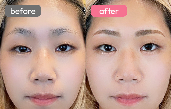 眉アートメイク-030 03