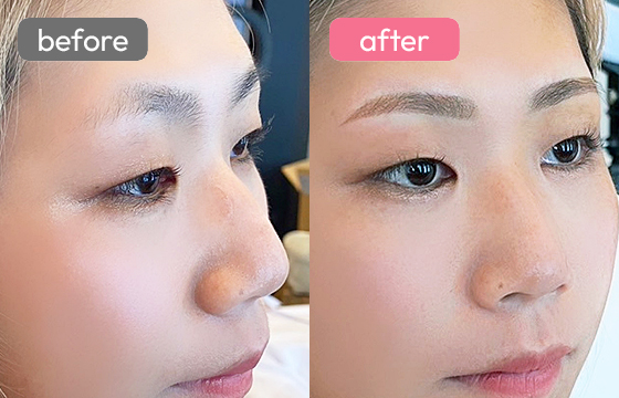 眉アートメイク-030 04