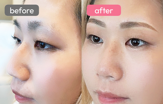 眉アートメイク-030 05