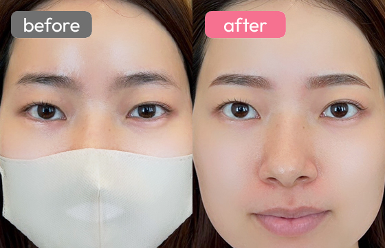 眉アートメイク-012 02