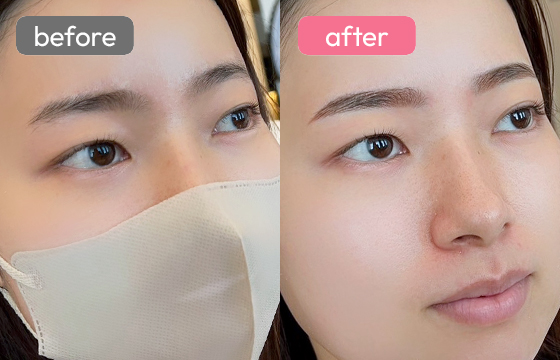 眉アートメイク-012 03