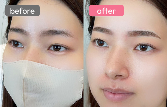 眉アートメイク-012