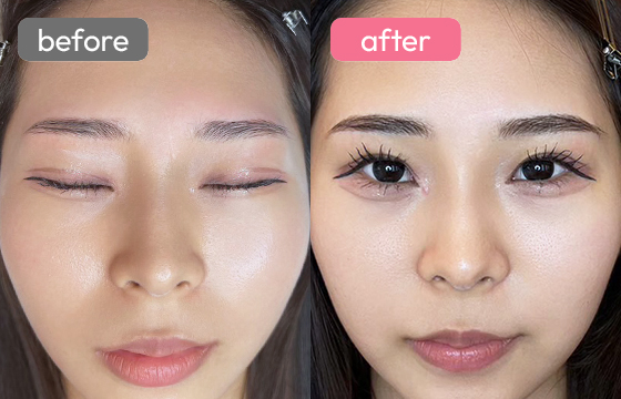 眉アートメイク-047