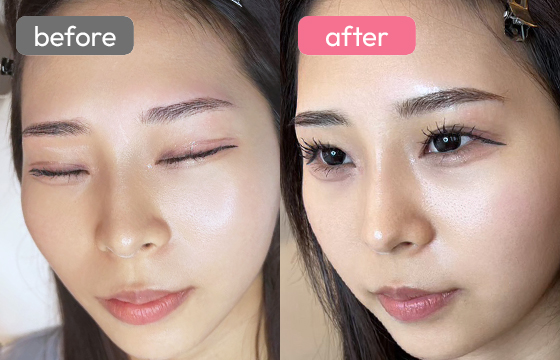 眉アートメイク-047 02