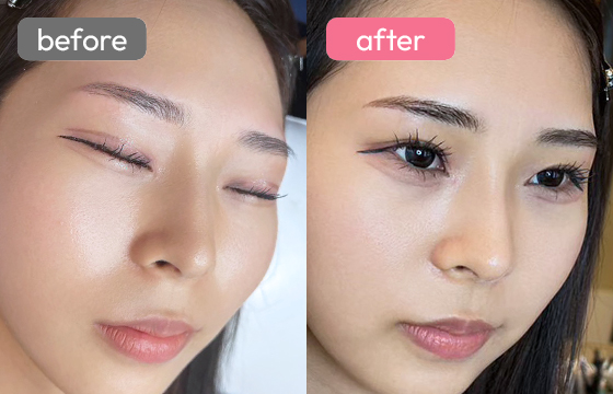 眉アートメイク-047 03