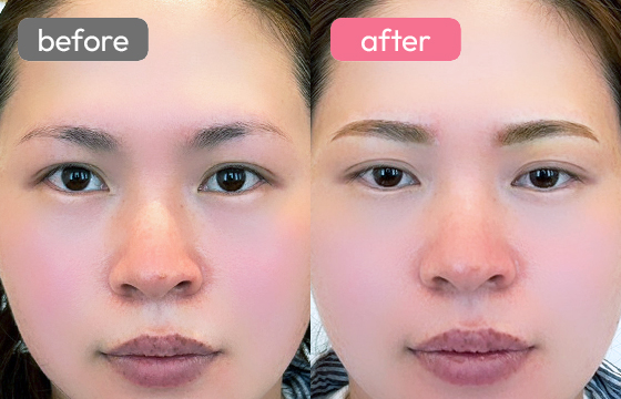 眉アートメイク-049 03