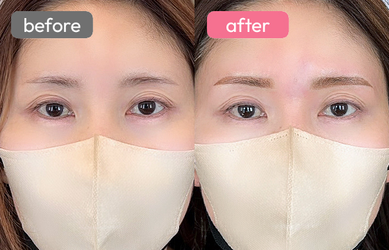 眉アートメイク-050 02