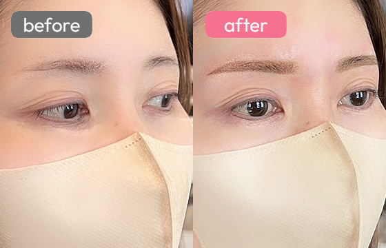 眉アートメイク-050 03