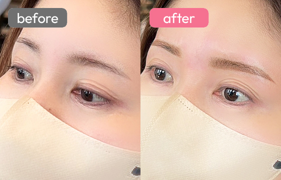 眉アートメイク-050