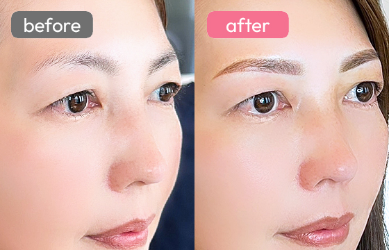 眉アートメイク-051 03