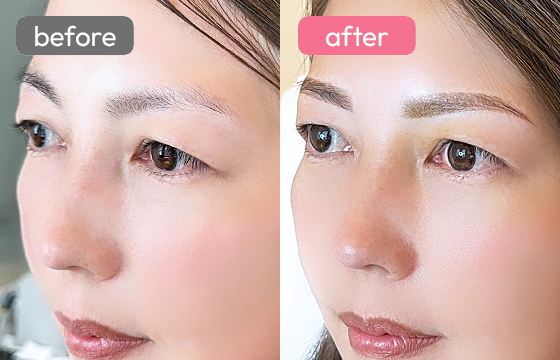 眉アートメイク-051 04