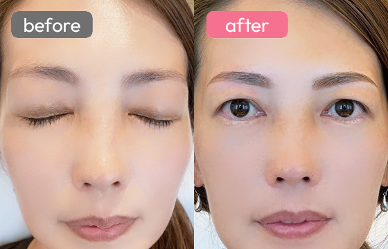 眉アートメイク-054