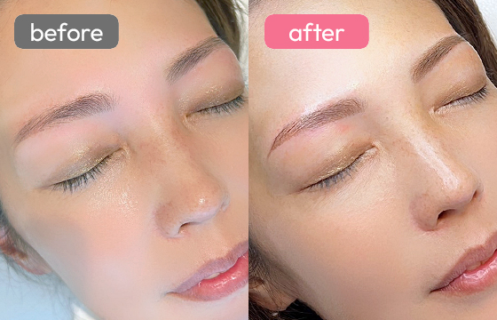 眉アートメイク-054 02