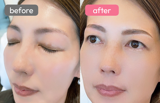 眉アートメイク-054 03