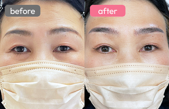 眉アートメイク-056