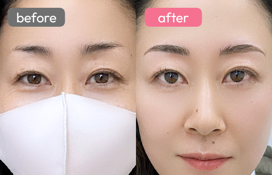 眉アートメイク-057