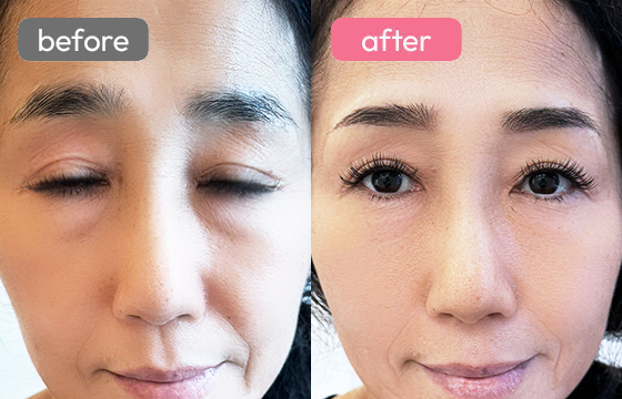 眉アートメイク-058 02