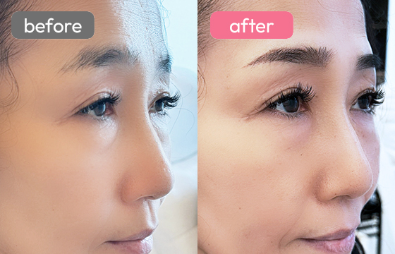 眉アートメイク-058 03