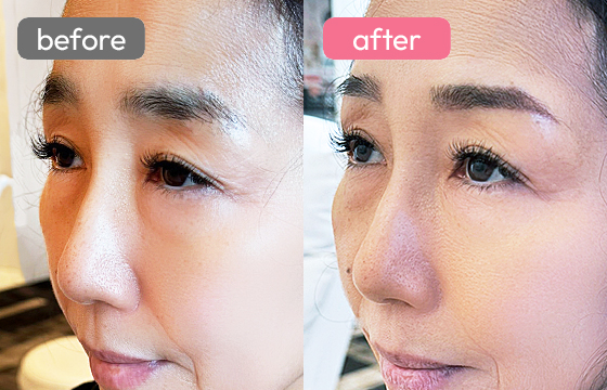 眉アートメイク-058