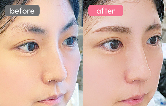 眉アートメイク-059