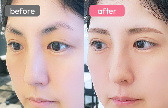 眉アートメイク-059 03