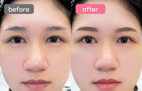 眉アートメイク-060 02