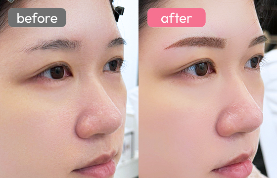 眉アートメイク-060 03