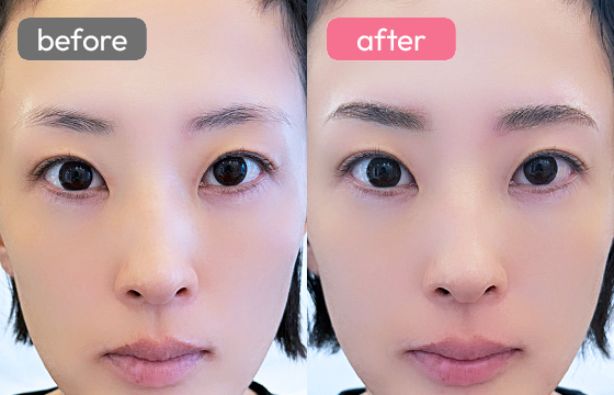 眉アートメイク-062 02