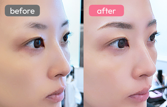 眉アートメイク-062 03