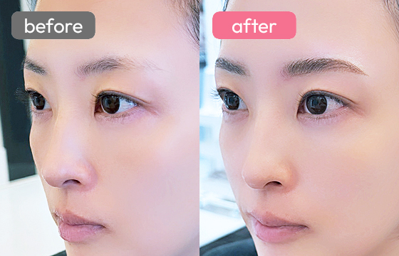 眉アートメイク-062