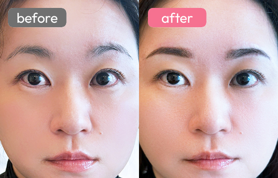 眉アートメイク-063