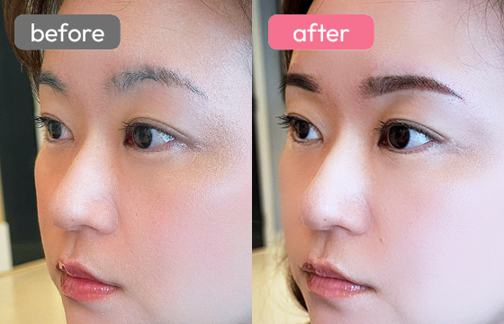 眉アートメイク-063 03