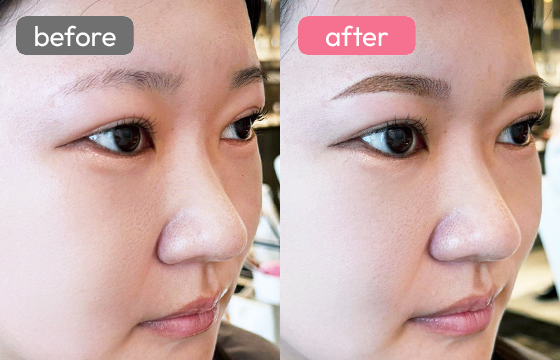 眉アートメイク-064 02