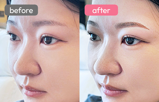 眉アートメイク-064 03