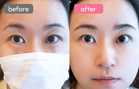 眉アートメイク-065