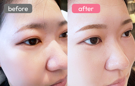 眉アートメイク-066 02