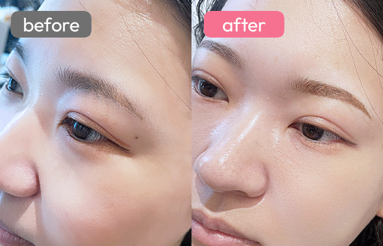 眉アートメイク-066 03