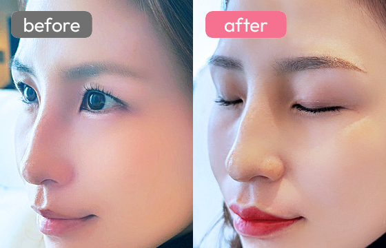 眉アートメイク-067 03