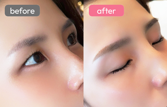 眉アートメイク-067