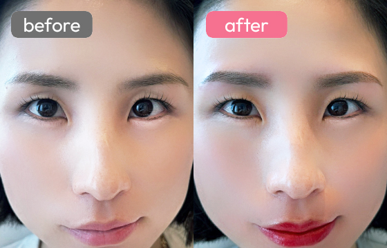 眉アートメイク-067 02