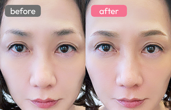 眉アートメイク-068 02