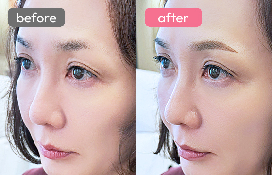 眉アートメイク-068 03