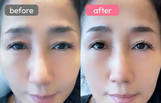 眉アートメイク-069 02