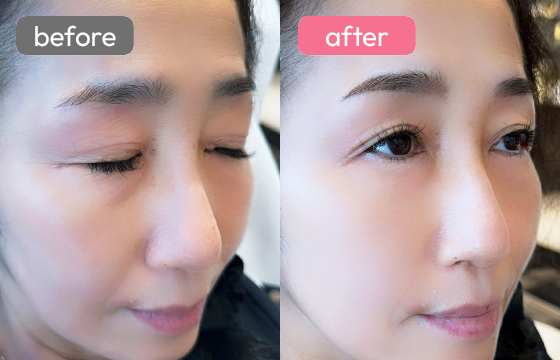 眉アートメイク-069