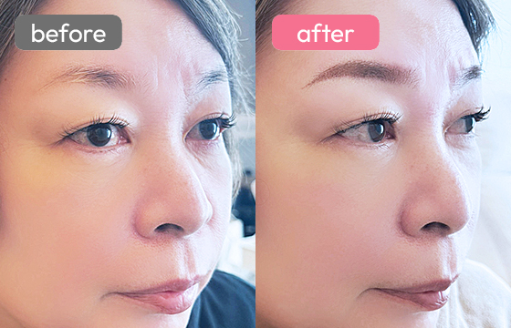 眉アートメイク-070 03