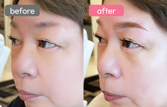 眉アートメイク-070