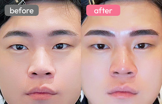 眉アートメイク(メンズ)02 02