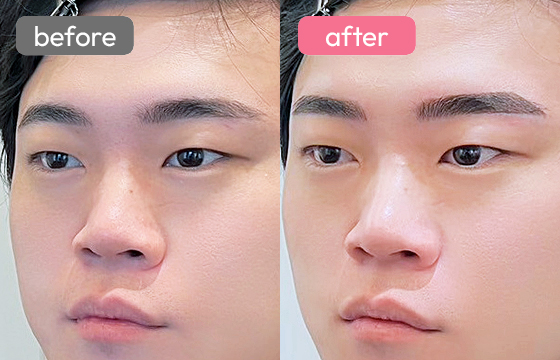 眉アートメイク(メンズ)02 03